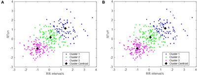 A New Method for Detecting Myocardial Ischemia Based on ECG T-Wave Area Curve (TWAC)